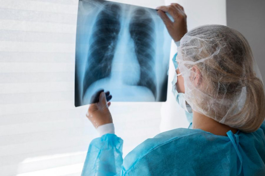 В Тамбовской области напряженная эпидемситуация по туберкулезу среди детского населения