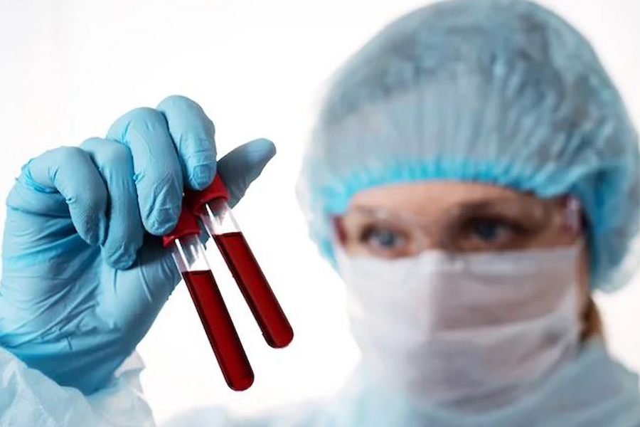 В Черноземье число заболевших коронавирусом снизилось из-за уменьшения тестов