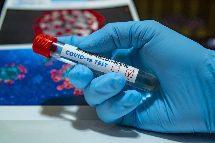 Обнаружен новый симптом коронавируса