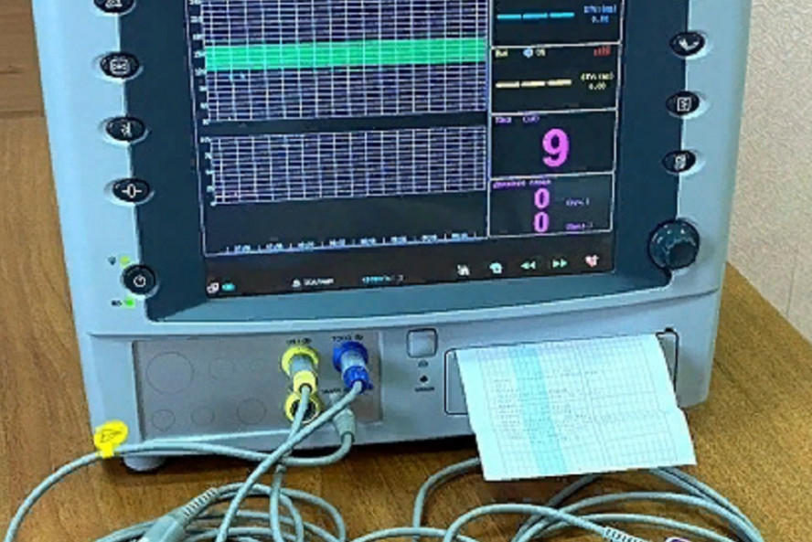 В четвёртую городскую больницу Тамбова поступило новое оборудование для обследования беременных