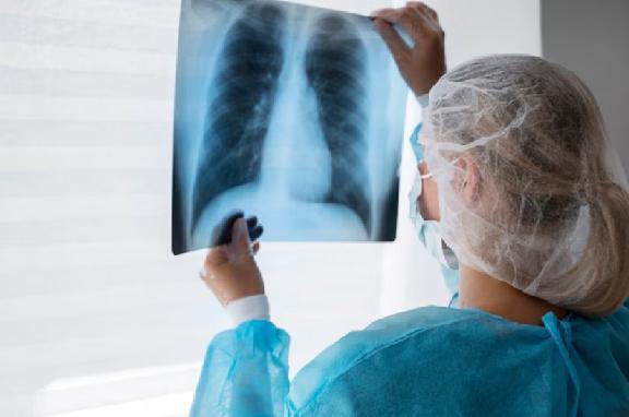 В Роспотребнадзоре рассказали о профилактике туберкулеза