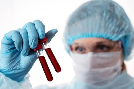 В Черноземье число заболевших коронавирусом снизилось из-за уменьшения тестов