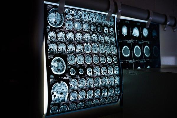 Тамбовская облбольница купила новый рентгеновский компьютерный томограф