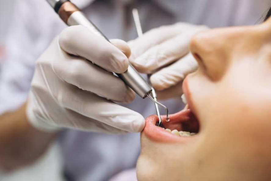 Стоматологические клиники заманивают клиентов низкой стоимостью услуг на импланты