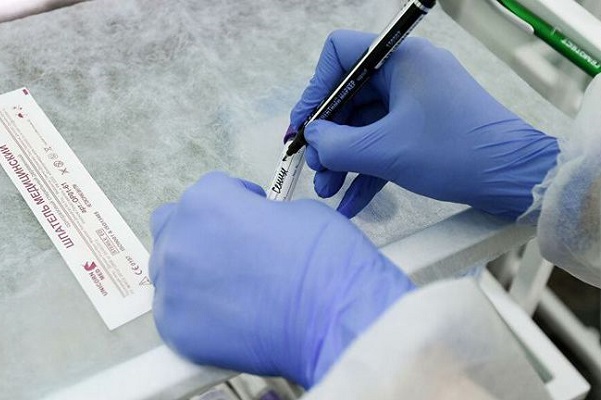Названы сроки регистрации теста на выявление иммунитета к COVID-19