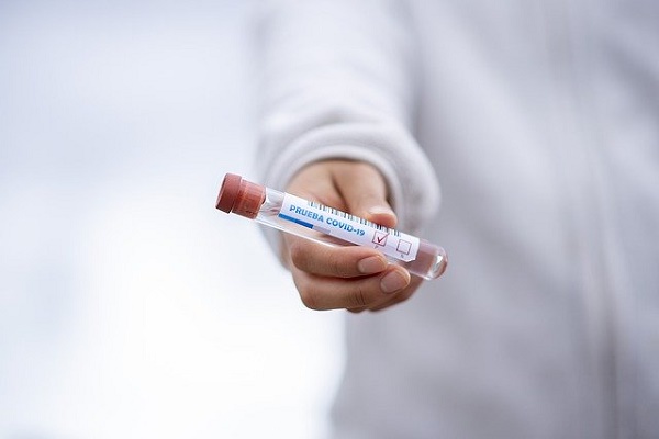В России провели более 5,4 млн тестов на коронавирус