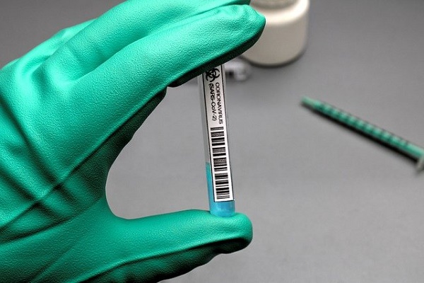 Эпидемиолог объяснил ошибки тестов на коронавирус