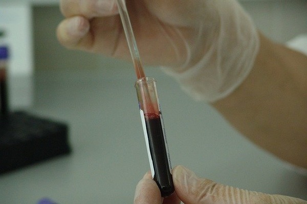 В Тамбовской области увеличилось число ВИЧ-инфицированных