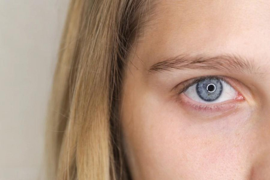 Невролог назвала причины подергивания глаза