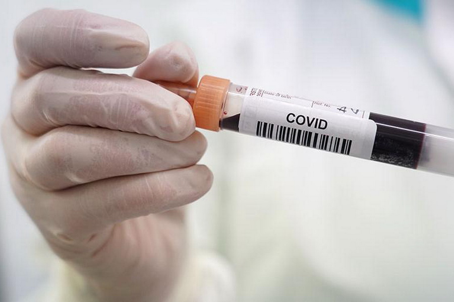 За сутки у 9200 россиян зафиксировали коронавирус