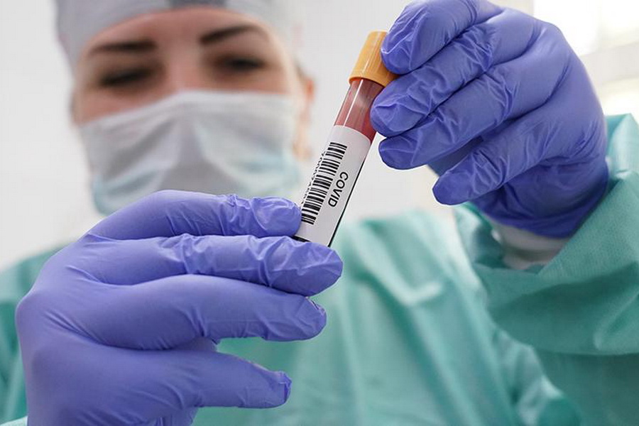 В России за сутки выявили 7728 новых случаев коронавируса