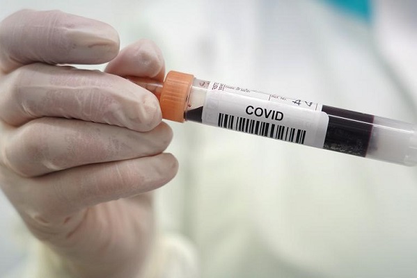 В правительстве назвали серьезным рост числа случаев коронавируса в России