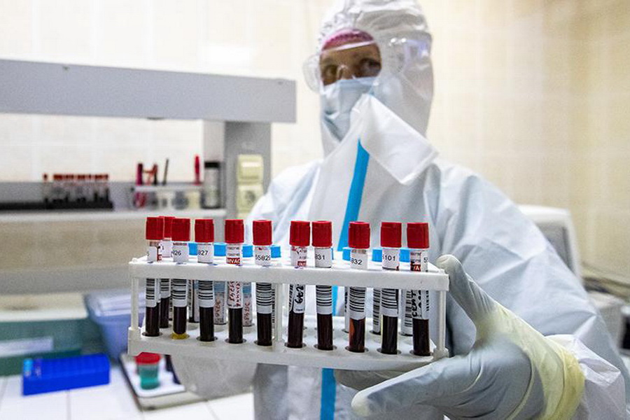 Впервые со 2 мая в России за сутки зафиксировали менее 10 000 заболевших коронавирусом